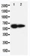 Interleukin 2 Receptor Subunit Beta antibody, LS-C312771, Lifespan Biosciences, Western Blot image 
