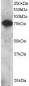 SET Domain And Mariner Transposase Fusion Gene antibody, MBS421149, MyBioSource, Western Blot image 