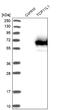 T-Complex 11 Like 1 antibody, NBP1-83749, Novus Biologicals, Western Blot image 