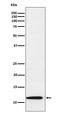 Thioredoxin 2 antibody, M04586, Boster Biological Technology, Western Blot image 