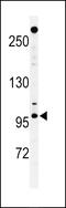 Nucleoporin 210 antibody, MBS9206926, MyBioSource, Western Blot image 