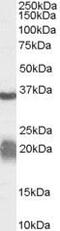 Arginase 1 antibody, PA5-18683, Invitrogen Antibodies, Western Blot image 