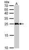 Glutathione S-Transferase Alpha 1 antibody, NBP1-32233, Novus Biologicals, Western Blot image 