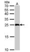 Glutathione S-transferase A1 antibody, NBP1-32233, Novus Biologicals, Western Blot image 