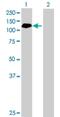 ABR Activator Of RhoGEF And GTPase antibody, H00000029-B01P, Novus Biologicals, Western Blot image 