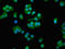 Chaperonin Containing TCP1 Subunit 7 antibody, LS-C671209, Lifespan Biosciences, Immunofluorescence image 
