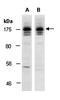 SOS Ras/Rho Guanine Nucleotide Exchange Factor 2 antibody, orb67258, Biorbyt, Western Blot image 