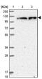 Zinc Finger CCCH-Type Containing 7A antibody, NBP1-82187, Novus Biologicals, Western Blot image 