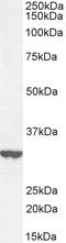 Integral Membrane Protein 2B antibody, LS-B6486, Lifespan Biosciences, Western Blot image 