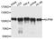 Nucleoporin 98 antibody, A0530, ABclonal Technology, Western Blot image 