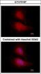 Forkhead Box O1 antibody, GTX70187, GeneTex, Immunofluorescence image 