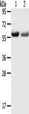 Solute Carrier Family 16 Member 9 antibody, TA351677, Origene, Western Blot image 