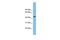 Collagen And Calcium Binding EGF Domains 1 antibody, GTX45753, GeneTex, Western Blot image 