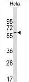 CD3e Molecule Associated Protein antibody, LS-C157630, Lifespan Biosciences, Western Blot image 