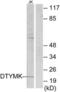 Deoxythymidylate Kinase antibody, LS-C118832, Lifespan Biosciences, Western Blot image 