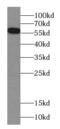 Carboxylesterase 5A antibody, FNab01618, FineTest, Western Blot image 