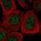 Amylo-Alpha-1, 6-Glucosidase, 4-Alpha-Glucanotransferase antibody, NBP2-55436, Novus Biologicals, Immunofluorescence image 