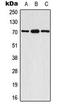 Ribosomal Protein S6 Kinase B1 antibody, LS-C354087, Lifespan Biosciences, Western Blot image 