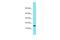 Transmembrane Protein 190 antibody, A17676, Boster Biological Technology, Western Blot image 