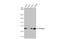 Phosphatidylinositol-4-Phosphate 5-Kinase Type 1 Alpha antibody, GTX111953, GeneTex, Western Blot image 