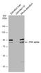 Protein Kinase C Alpha antibody, GTX130453, GeneTex, Western Blot image 