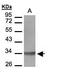 LTB4 antibody, GTX108169, GeneTex, Western Blot image 