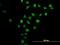 Cyclin And CBS Domain Divalent Metal Cation Transport Mediator 3 antibody, H00026505-B01P, Novus Biologicals, Immunocytochemistry image 