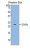 Colony Stimulating Factor 3 Receptor antibody, LS-C293459, Lifespan Biosciences, Western Blot image 