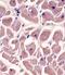 Myosin Binding Protein C, Cardiac antibody, PA5-71701, Invitrogen Antibodies, Immunohistochemistry frozen image 