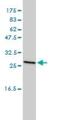 Clathrin Light Chain B antibody, H00001212-M01, Novus Biologicals, Western Blot image 