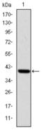 Tyrosine-protein kinase ITK/TSK antibody, abx015901, Abbexa, Western Blot image 