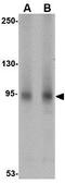 AP2 Associated Kinase 1 antibody, GTX17023, GeneTex, Western Blot image 
