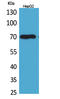 Glypican 3 antibody, STJ96571, St John