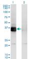 PHD Finger Protein 11 antibody, H00051131-M01, Novus Biologicals, Western Blot image 