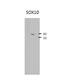 SRY-Box 10 antibody, 27-829, ProSci, Western Blot image 