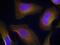 Protein Kinase C Theta antibody, P01293, Boster Biological Technology, Immunofluorescence image 