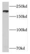 Nucleoporin 205 antibody, FNab05923, FineTest, Western Blot image 