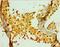 Phosphoinositide Kinase, FYVE-Type Zinc Finger Containing antibody, LS-C380358, Lifespan Biosciences, Immunohistochemistry paraffin image 