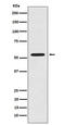 Lectin, Mannose Binding 1 antibody, M03628-3, Boster Biological Technology, Western Blot image 