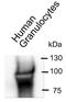 Carcinoembryonic Antigen Related Cell Adhesion Molecule 6 antibody, NBP2-54626, Novus Biologicals, Immunoprecipitation image 