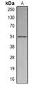 SET Domain Containing 6, Protein Lysine Methyltransferase antibody, orb341259, Biorbyt, Western Blot image 