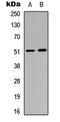 Gamma-Aminobutyric Acid Type A Receptor Alpha6 Subunit antibody, LS-C358754, Lifespan Biosciences, Western Blot image 