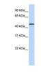 MAGE Family Member A10 antibody, NBP1-57674, Novus Biologicals, Western Blot image 