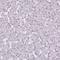 X-Ray Repair Cross Complementing 6 antibody, NBP2-38954, Novus Biologicals, Immunohistochemistry paraffin image 