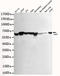 Heat Shock Protein Family D (Hsp60) Member 1 antibody, STJ99294, St John