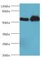 Aldehyde Dehydrogenase 1 Family Member A2 antibody, MBS1492766, MyBioSource, Western Blot image 