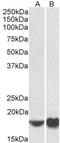 ADP Ribosylation Factor 4 antibody, PA5-37841, Invitrogen Antibodies, Western Blot image 