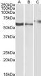 Purinergic Receptor P2X 4 antibody, PA5-18994, Invitrogen Antibodies, Western Blot image 