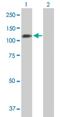 Protein Phosphatase 1 Regulatory Subunit 13 Like antibody, H00010848-B01P, Novus Biologicals, Western Blot image 