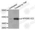 NFKB Inhibitor Epsilon antibody, AP0212, ABclonal Technology, Western Blot image 